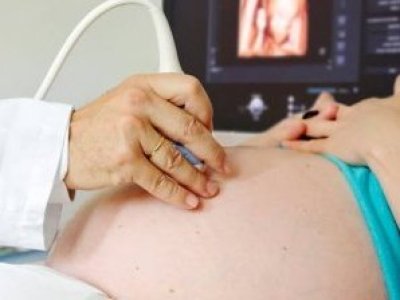 Proyecto de ley busca exigir escuchar latidos fetales antes de acceder al aborto en dos causales legales